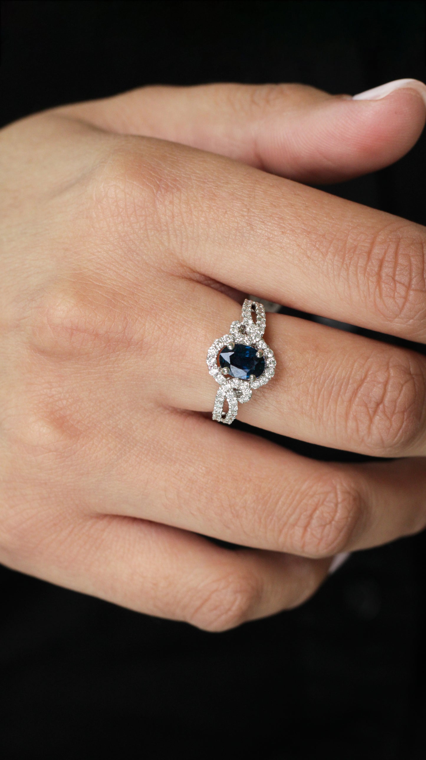 Anillo Orelisse