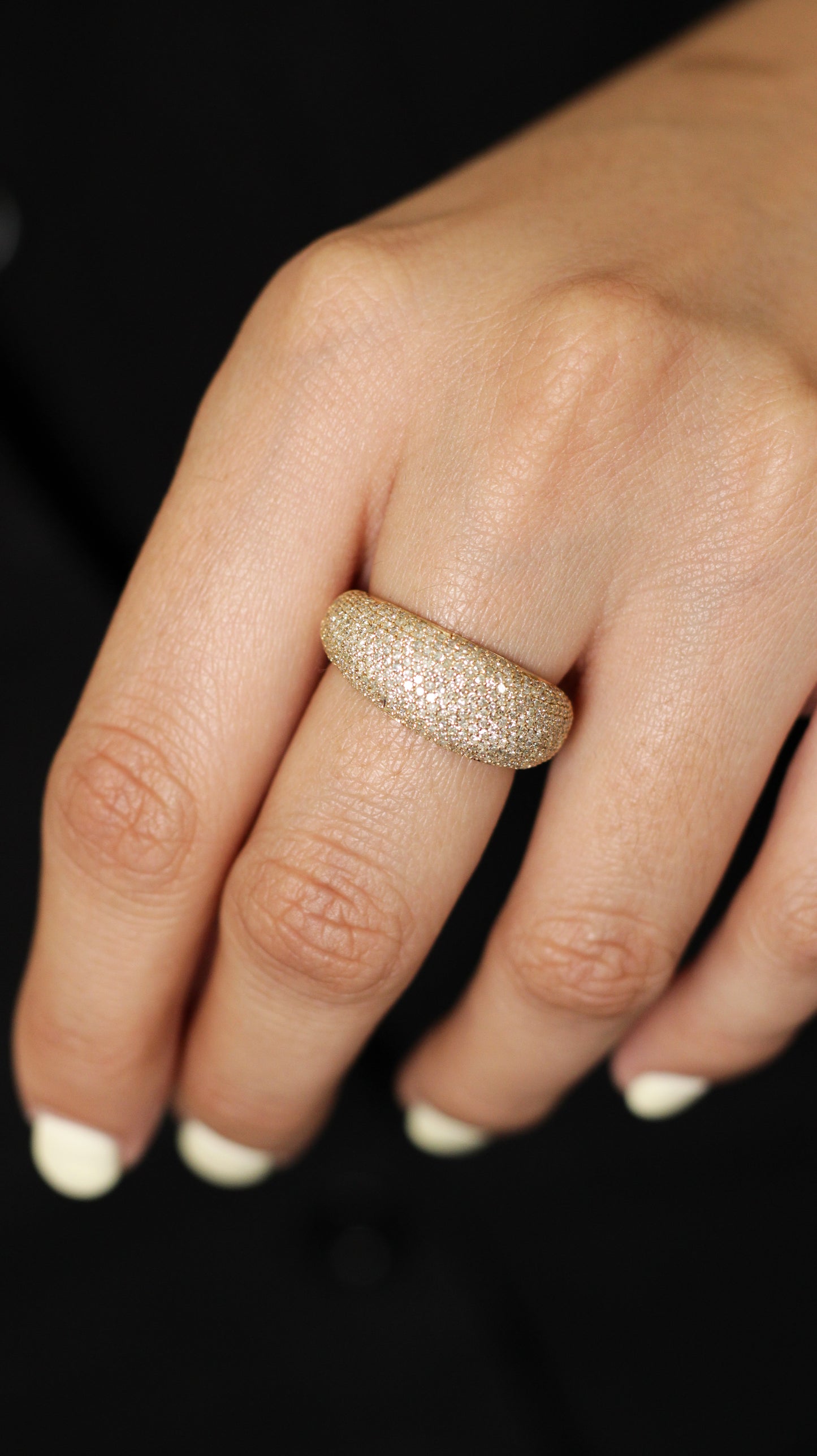 Anillo Chepi