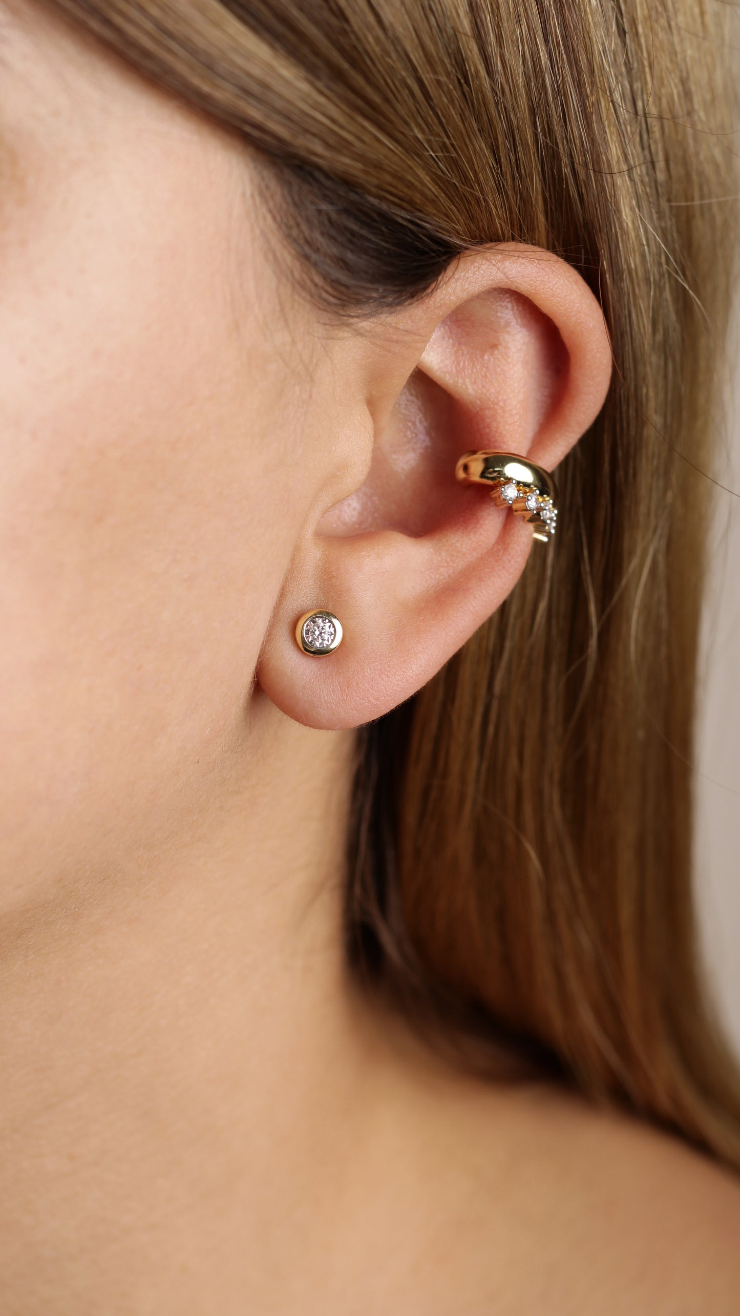 Aretes Orbe